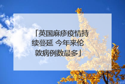 英国麻疹疫情持续蔓延 今年来伦敦病例数最多